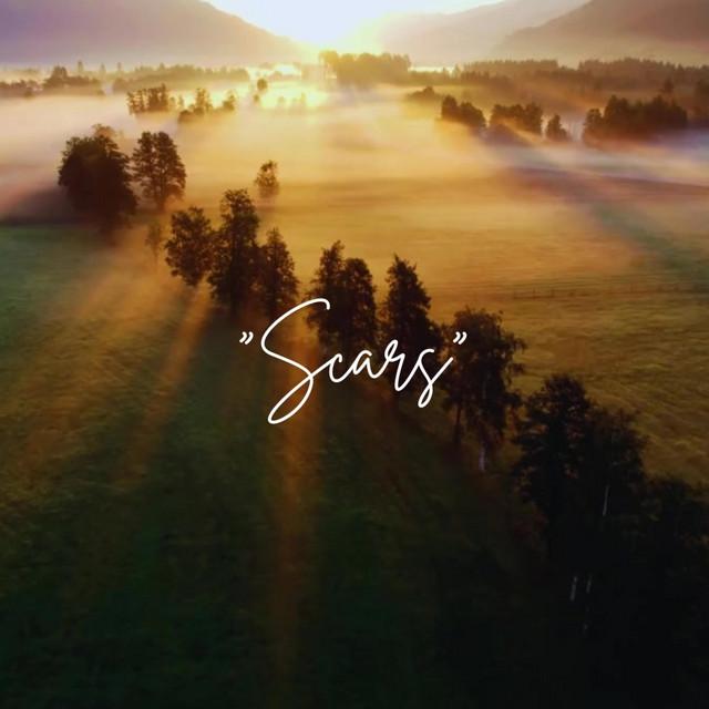 Scars