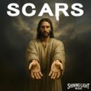 Scars
